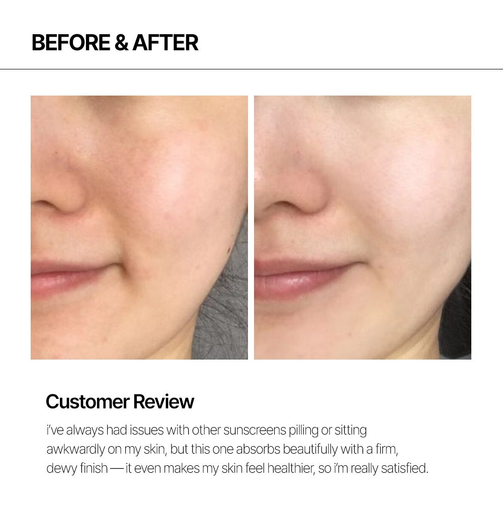 Pretective Sun Recover