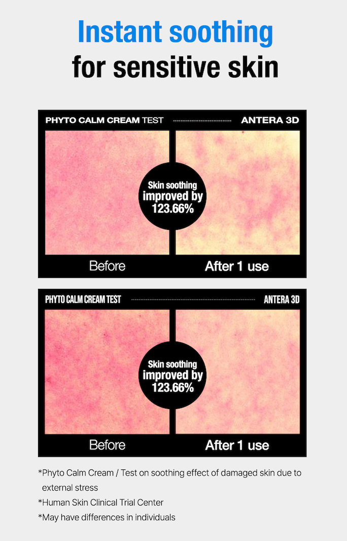 Phyto-calm Cream