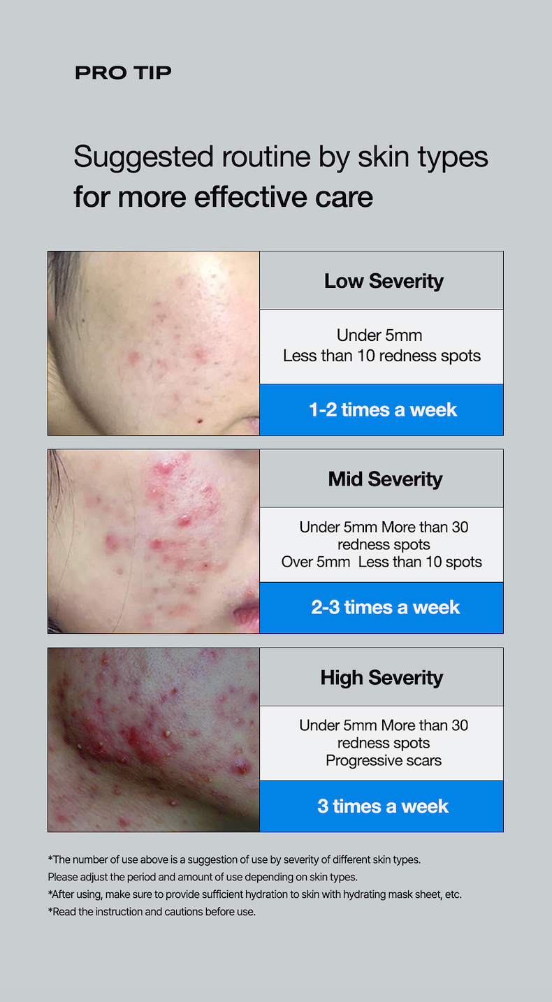 ACNE WASH 23 AMPOULE